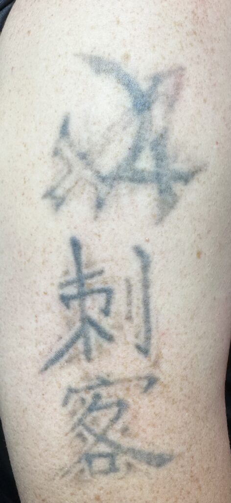 MorphIUs Laser and Longevity Studio Fremantle