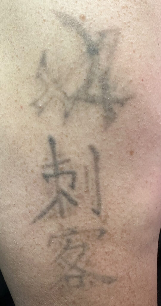 MorphIUs Laser and Longevity Studio Fremantle-