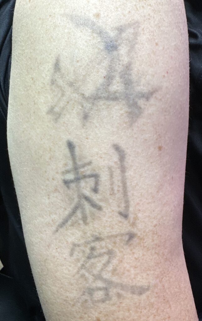 MorphIUs Laser and Longevity Studio Fremantle