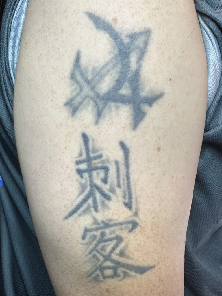 MorphIUs Laser and Longevity Studio Fremantle