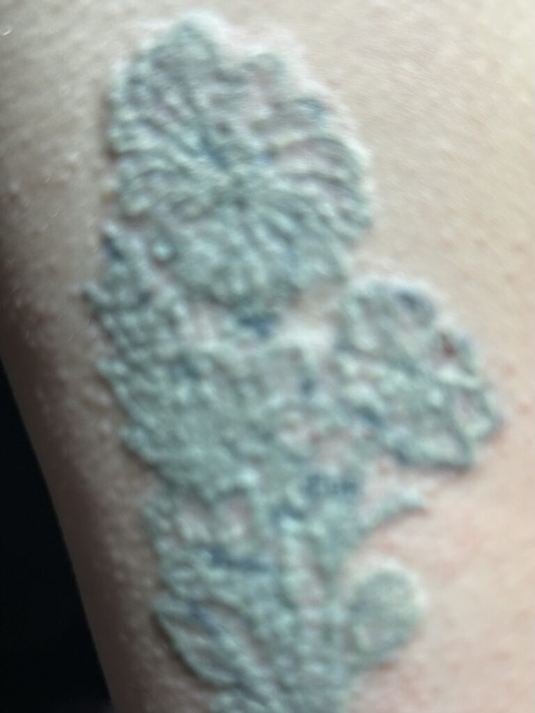 MorphIUs Laser and Longevity Studio Fremantle